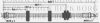 BORG & BECK BBH7373 Brake Hose